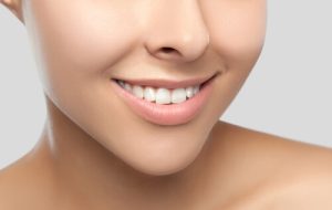 non-surgical dental facelift smile